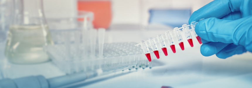 Анализ крови на амилазу Анализ крови на амилазу