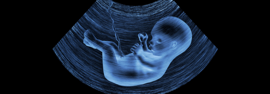 УЗИ 3Д/4Д УЗИ 3Д/4Д