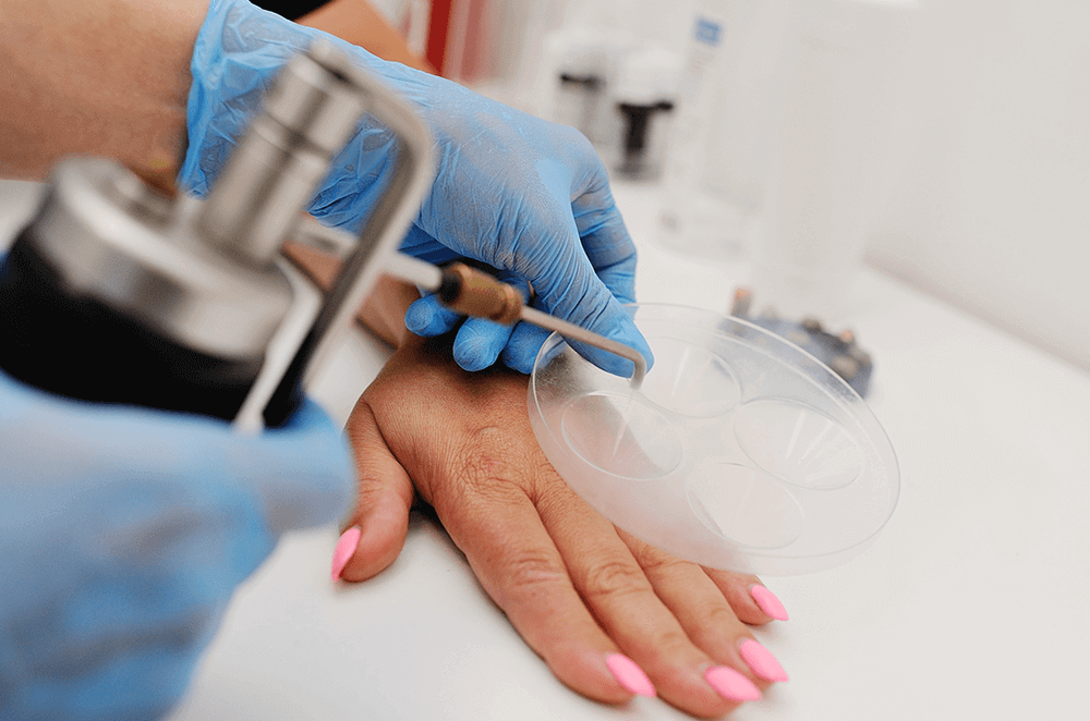 Криодеструкция Криодеструкция