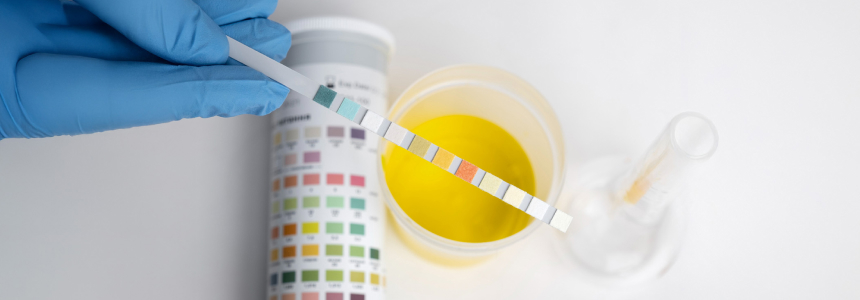 Анализ на лютеинизирующий гормон Анализ на лютеинизирующий гормон